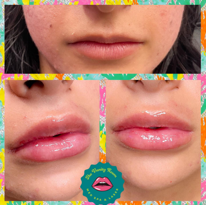 The Vanity Room Med Spa in Orlando, FL