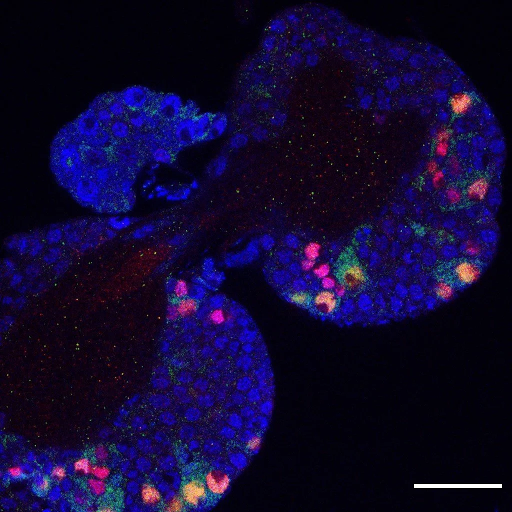 Brain lobes of fruit fly larva with all neural stem cells in red, neural stem cells that are about to divide in green and a histone modification (H3K4me3) in blue. Scale bar is 50µm. Image by Anna Malkowska.