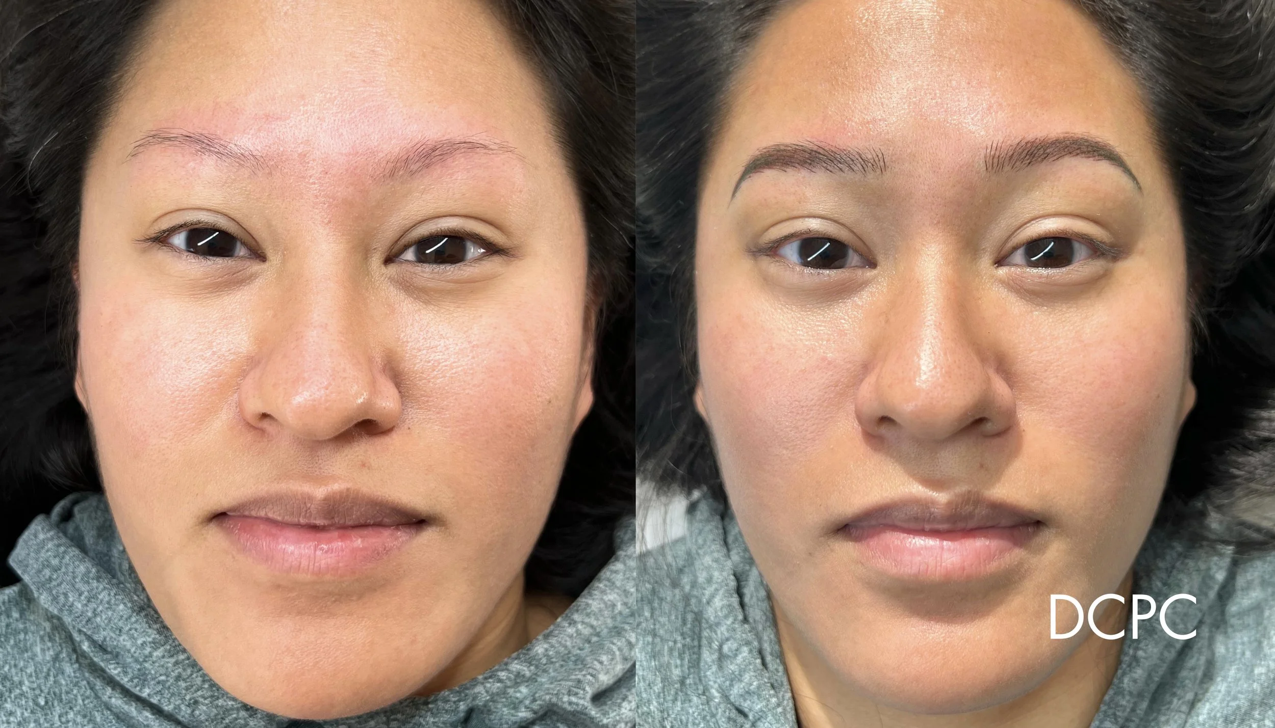 FRAMEO PORTFOLIO.png.jpeg