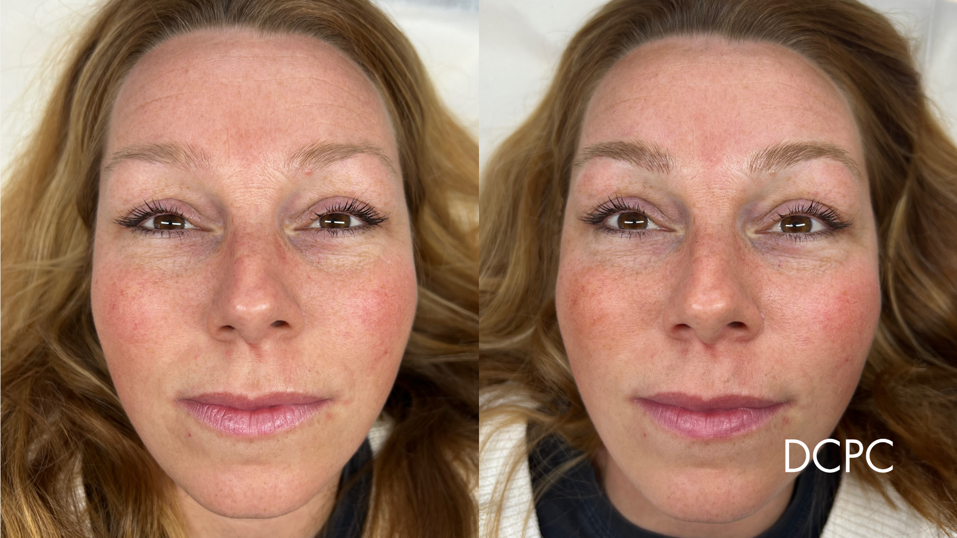 FRAMEO PORTFOLIO - 24.png