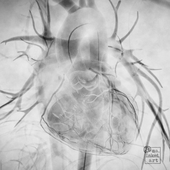 I missed Valentine's day, but it's still February and it's never too late to say 👁️🖤U right? This is the &quot;🖤&quot; in my three-part Valentine's series. Visit my profile to see the full series 😘

I know, this isn't a pen and ink illustration, 