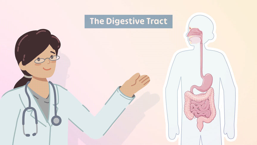 Perianal fistulas in Crohn's disease (3 Part series)