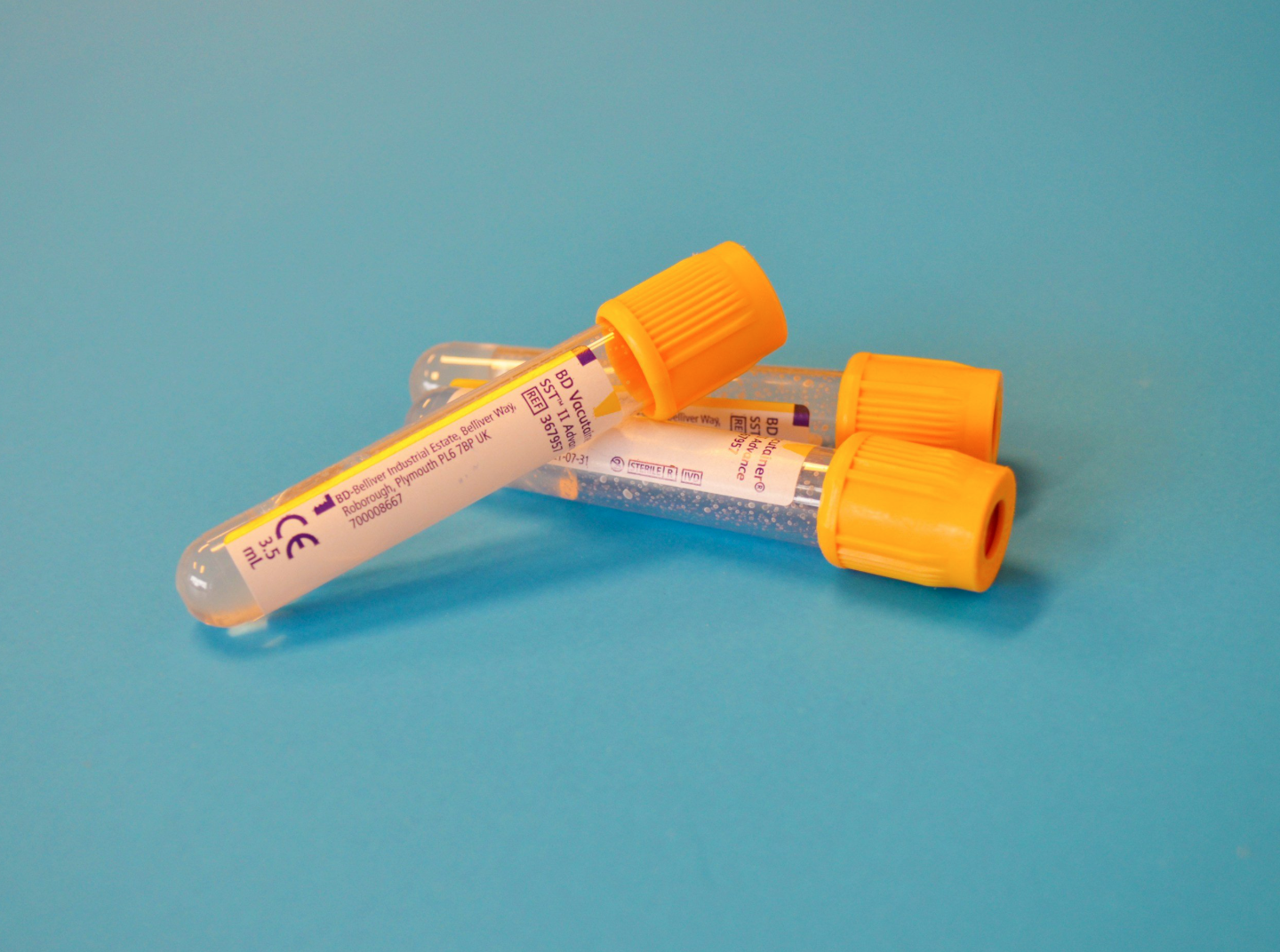 What Labs to Request if You Suspect Functional Hypothalamic Amenorrhea (HA)