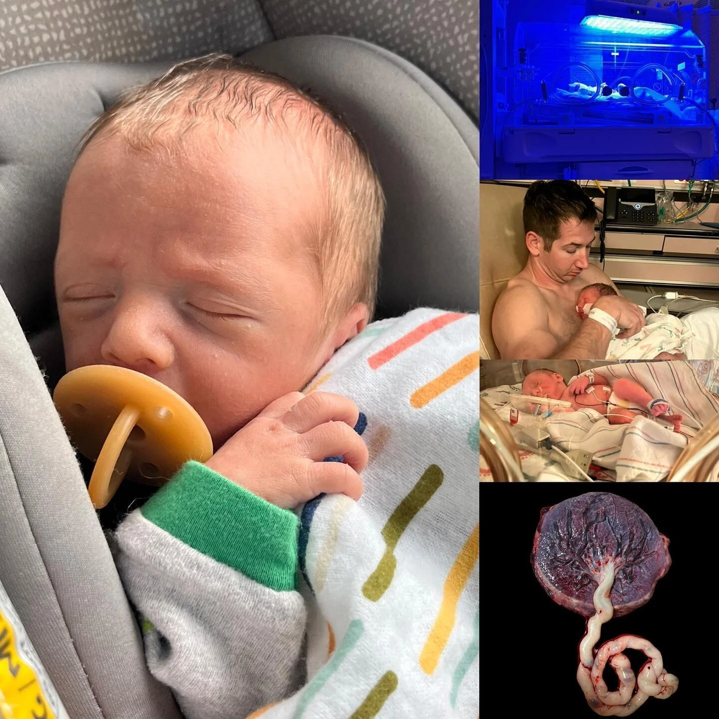 Last Tuesday, March 22nd, I was working at my clinic like any other Tuesday and completely ignoring the fact that I was in labor. 
I was only 35 weeks pregnant, I couldn&rsquo;t be in labor! I planned my second home birth for my third baby, I had a b