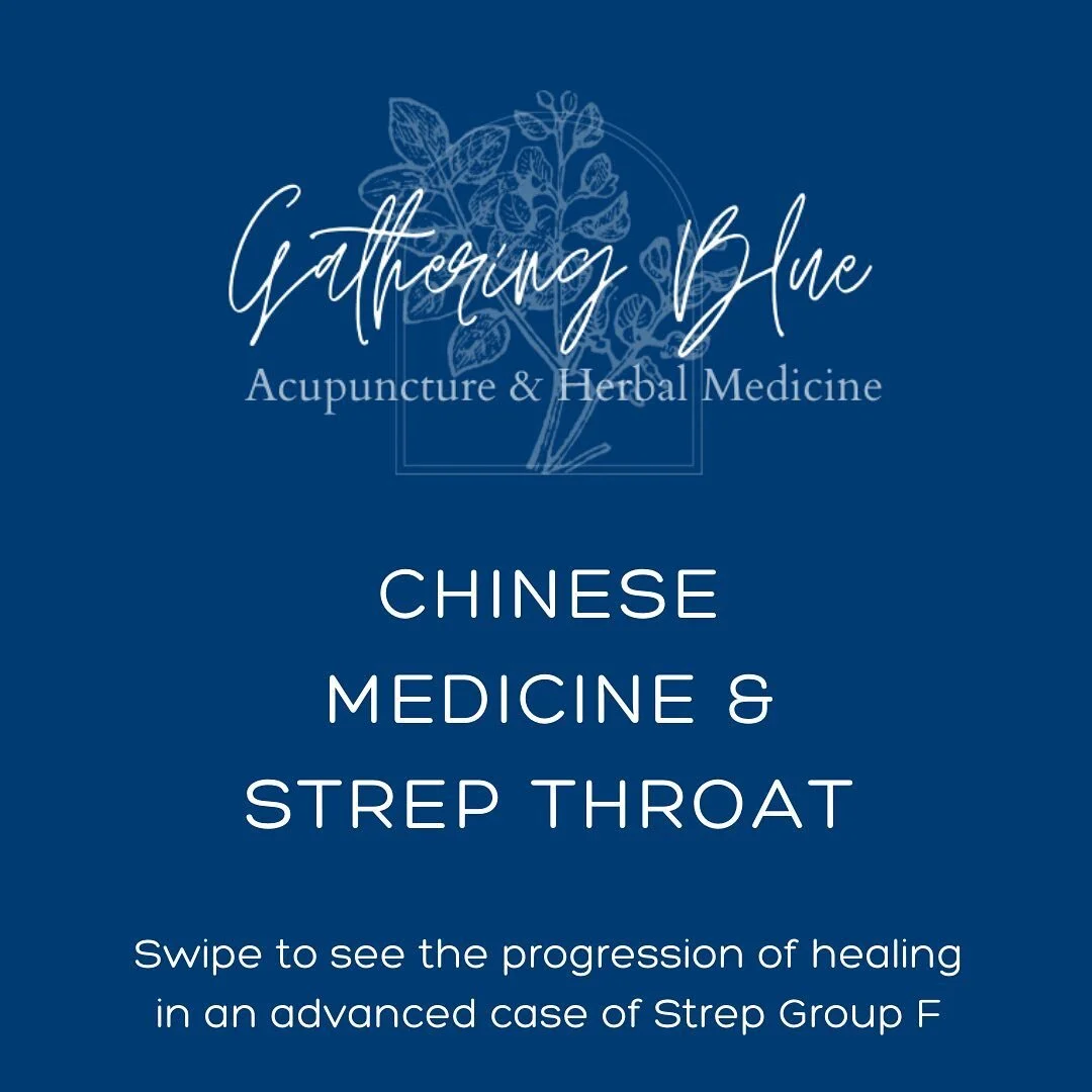 **Warning: Pictures of the back of a throat*** 

While we were in the hospital last week, my two older sons were with my parents.

On Sunday night my mom said he had a fever and his head hurt and everything was okay, so I called in the morning to che