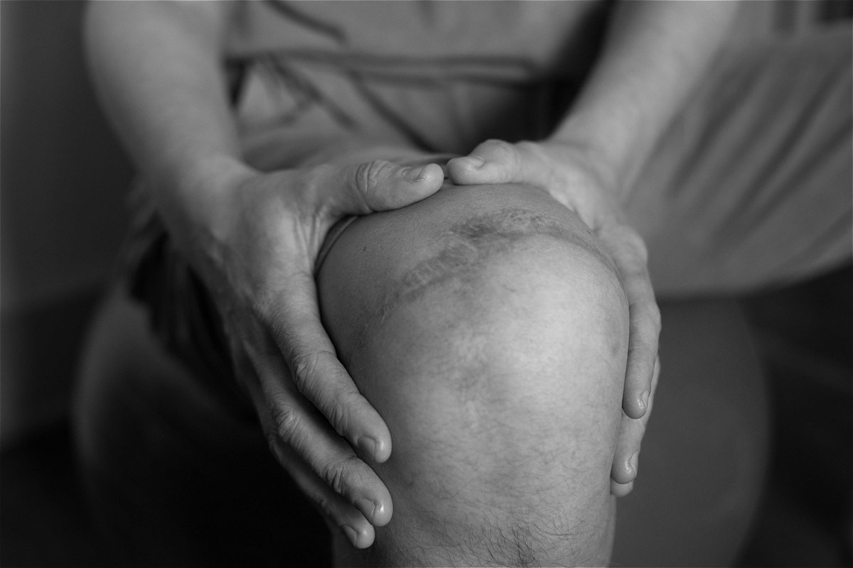 Person clutching knee, scar visible