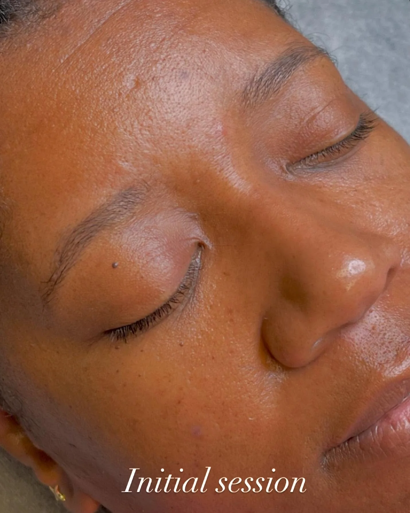 If you&rsquo;re thinking about getting your brows done, DO IT!&rdquo; 

Treatment- Powder brows
Duration: 3 hrs
Pain level (1-10 scale) - 3
Healing period: 2 weeks
Retention: 1 - 1.5 years before touch up
~~~~~~~~~~~~~~~~~~~~~~~~~~~~~
To book, call o