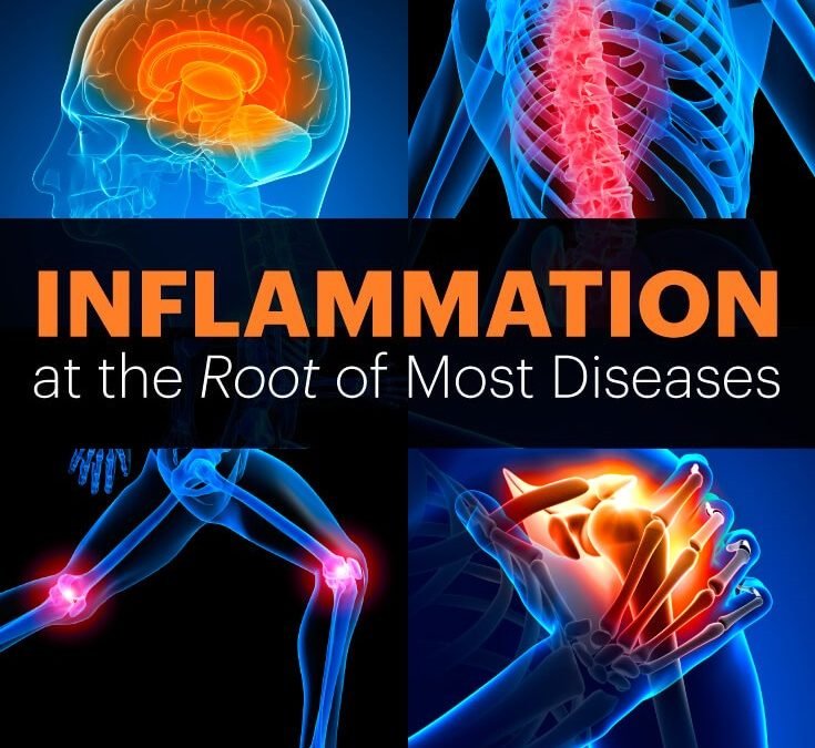 Inflammation and chronic disease states
