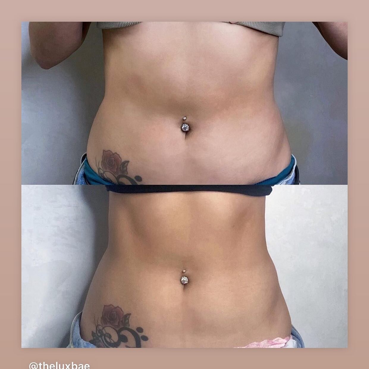 Evolve! This client had 6 sessions of trim and tone and look at her results!
Pain free no downtime and noninvasive 7803405323 or visit link in bio