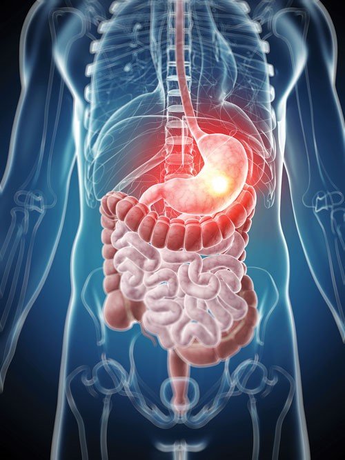 Dairy &amp; Gut Health
