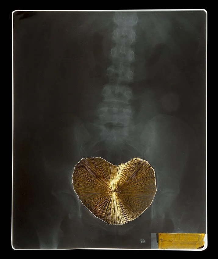 1_Passages Xray.3.jpg
