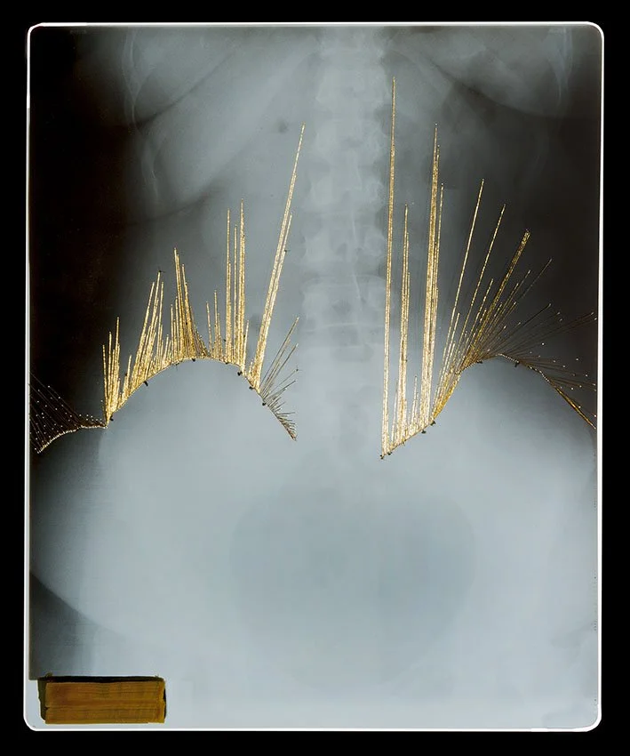 1_Passages Xray.1.jpg