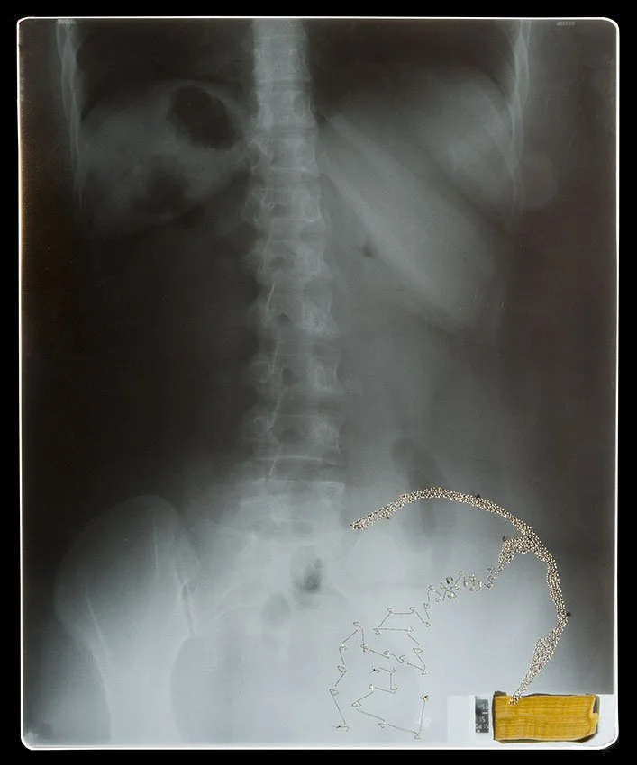 1_Passages Xray.2.jpg