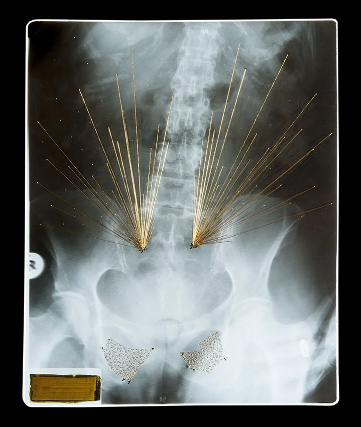 1_Passages Xray.5.jpg
