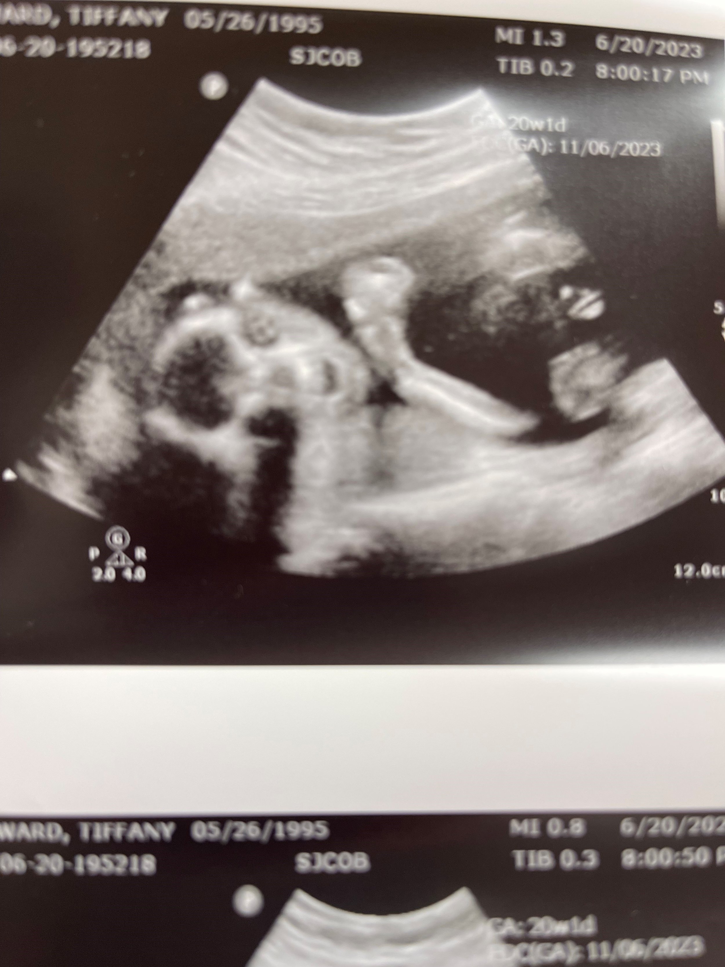 Kin ultrasound smiling.jpg