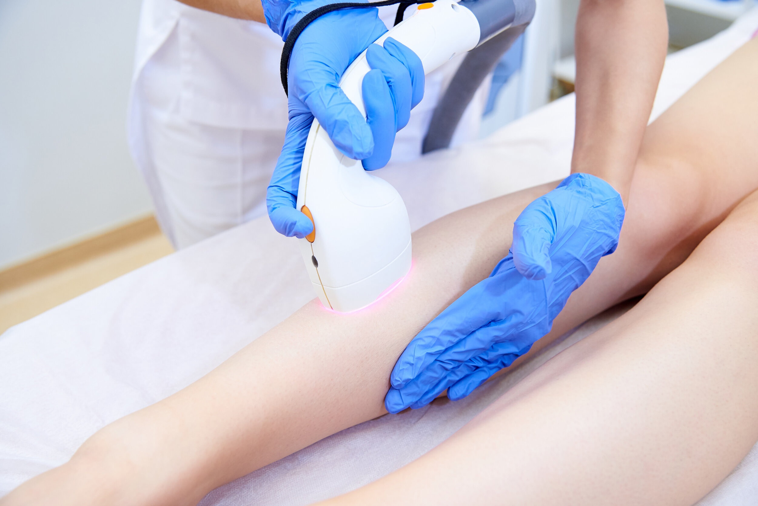 Half Leg:
If you prefer to remove unwanted hair from specific areas of your legs, our half leg hair removal service is designed for you. Our skilled professionals use advanced diode laser technology to target hair follicles on the lower or upper hal