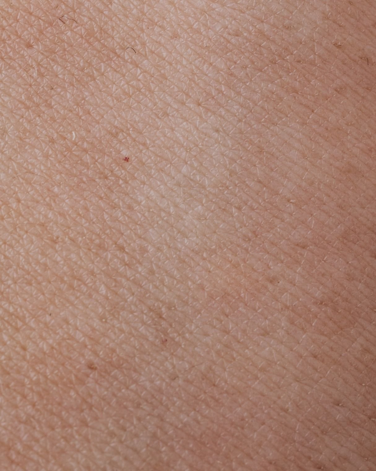 Close-up of human skin showing texture, pores, and fine hair.