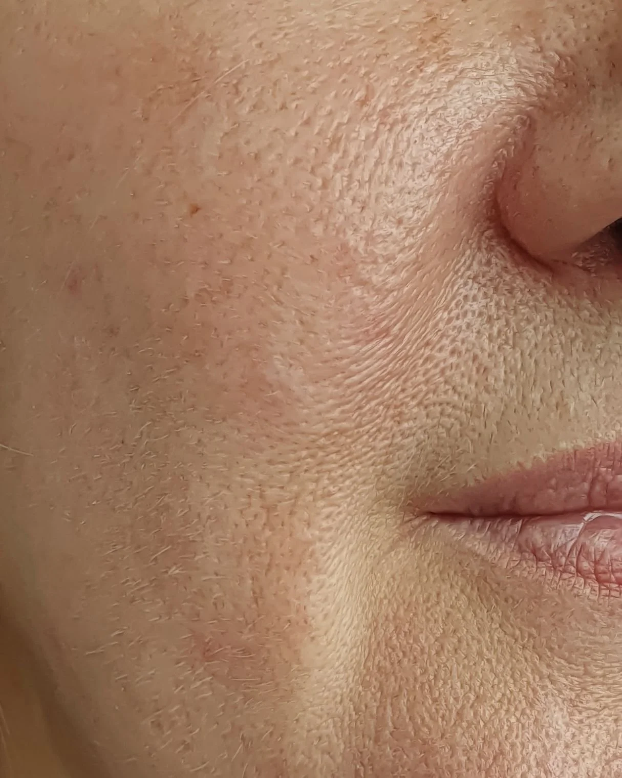 Close-up of a person's nose and lips, showing skin texture and pores.