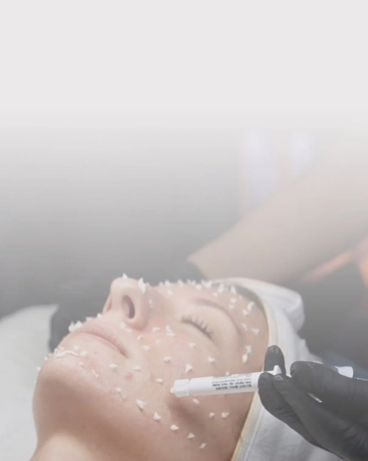 A person lying down at a clinic or spa with eyes closed, receiving a facial treatment that involves microdermabrasion or a similar skin procedure, performed by a professional wearing black gloves.
