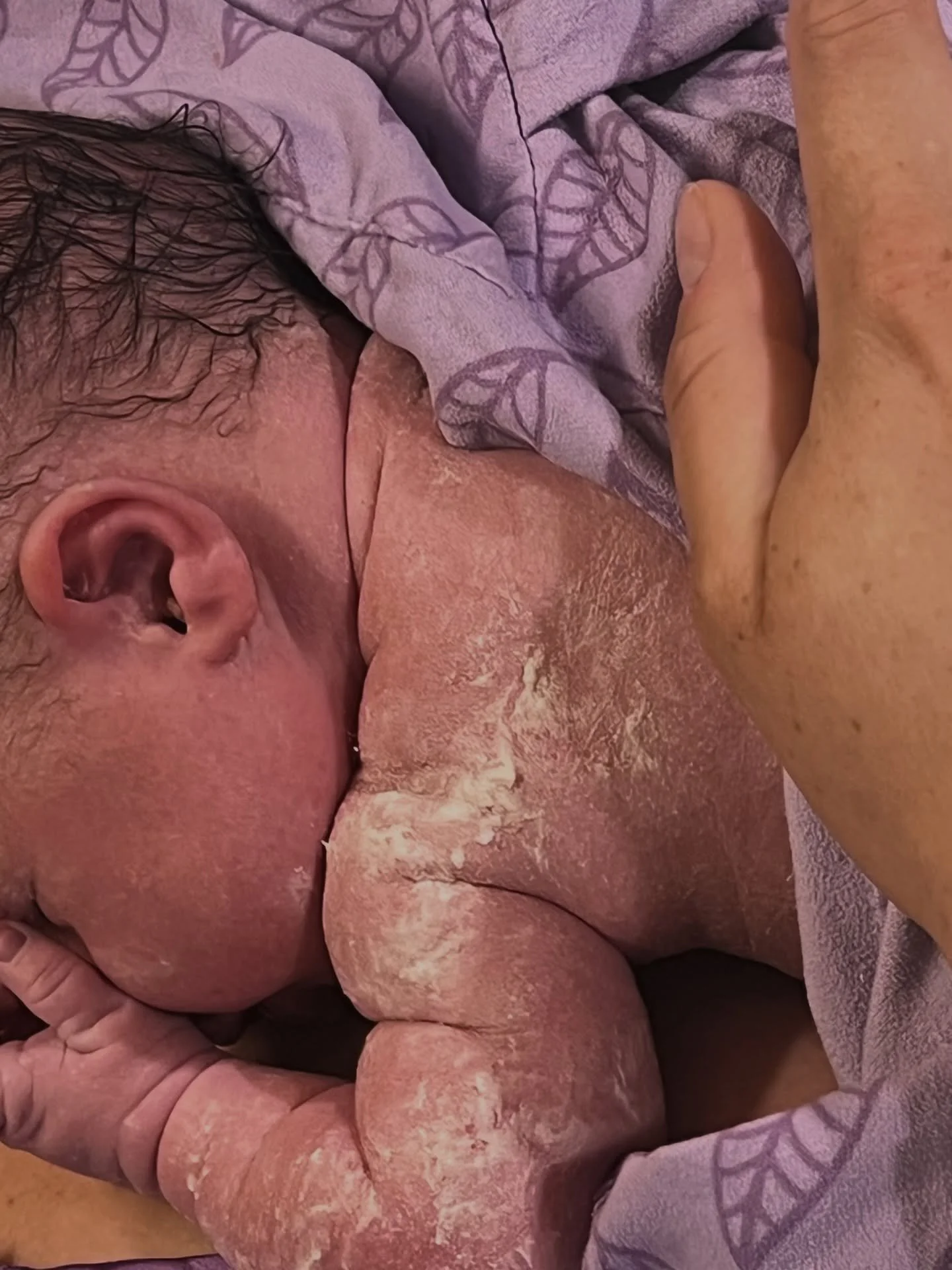 Vernix! The original birth-day frosting 🧁 

This creamy white layer some babies are born with is so much more than it looks. It helps regulate temperature, protects delicate skin, supports microbiome development, and even has natural antibacterial p