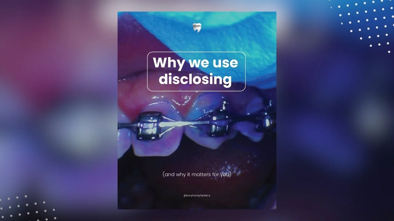 Why We Use Disclosing at Ivory Family Dentistry
