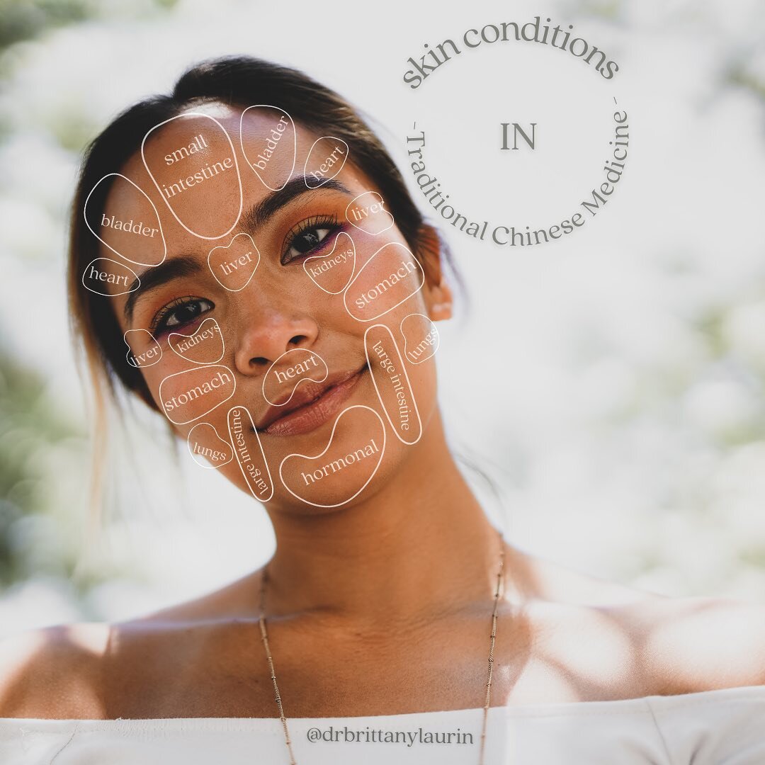 What is your skin telling you? 

Do you always get blemishes in the same location? 

Being trained in Traditional Chinese Medicine allows me to incorporate other perspectives into your diagnosis. 

✨ Use the link in my bio to book a Naturopathic Skin