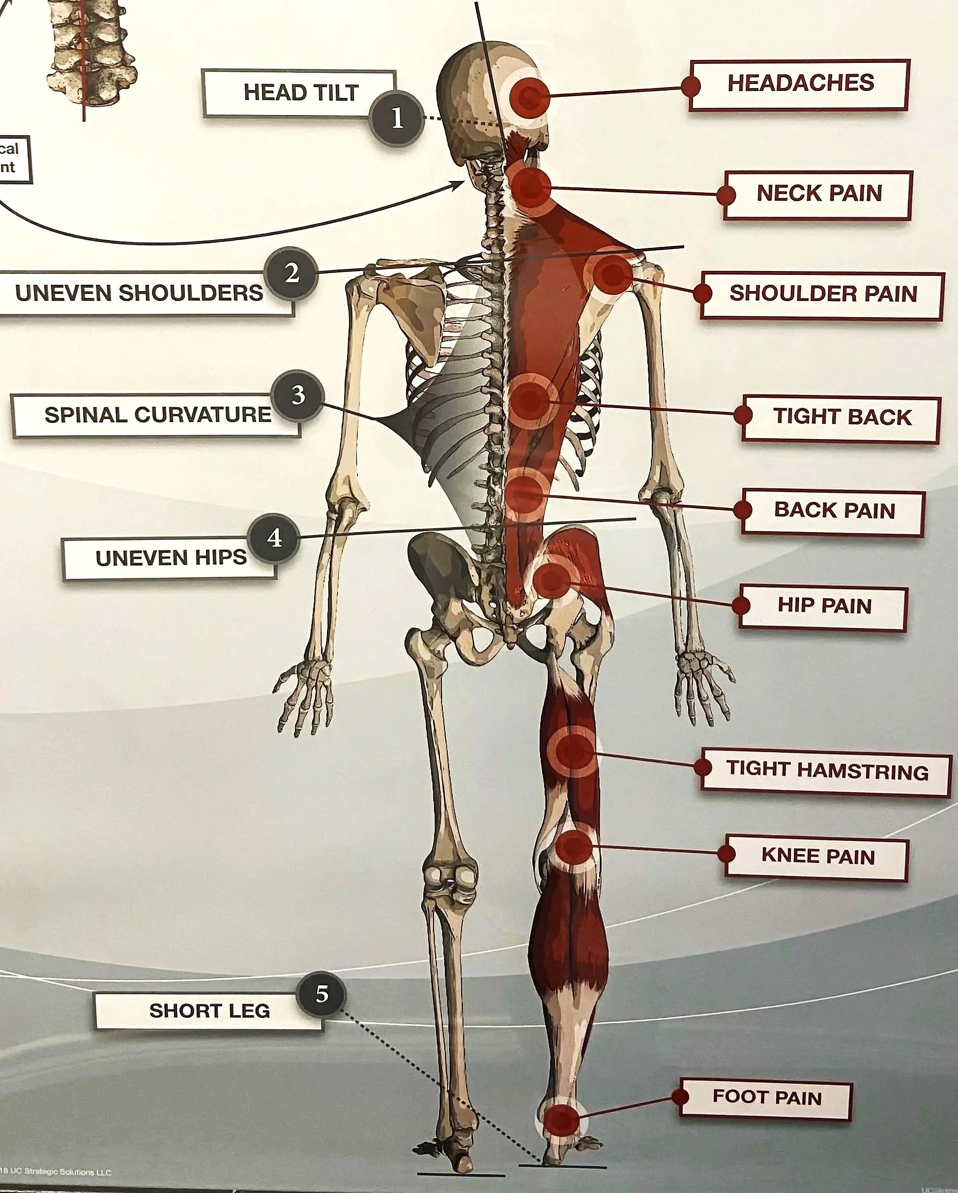 Skeletal posture diagram used to explain spinal alignment during chiropractic exams at Be Well Chiropractic in Lakeway, TX