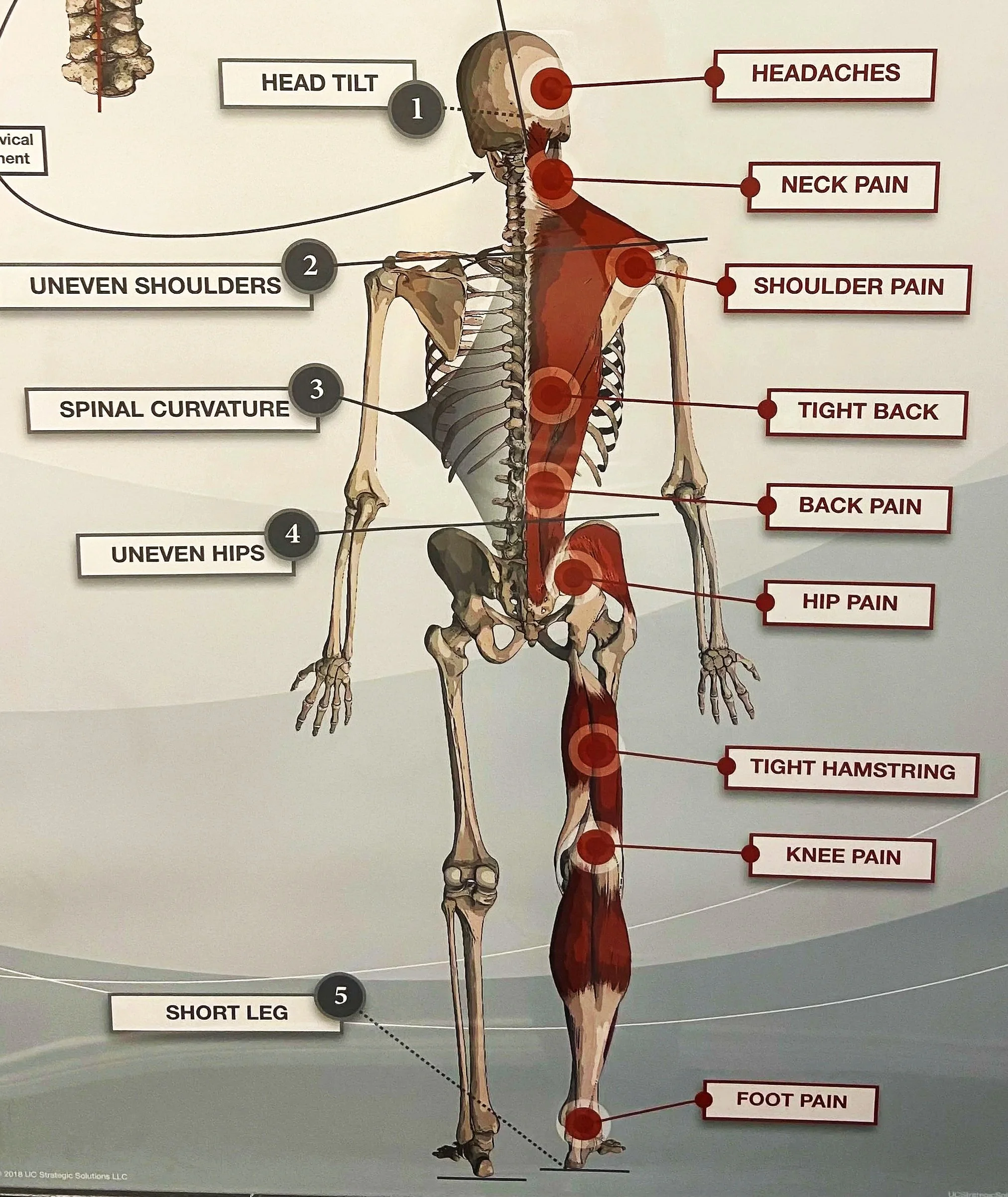 Diagram showing how upper cervical misalignment relates to posture, headaches, and back pain — Be Well Chiropractic, Lakeway, TX