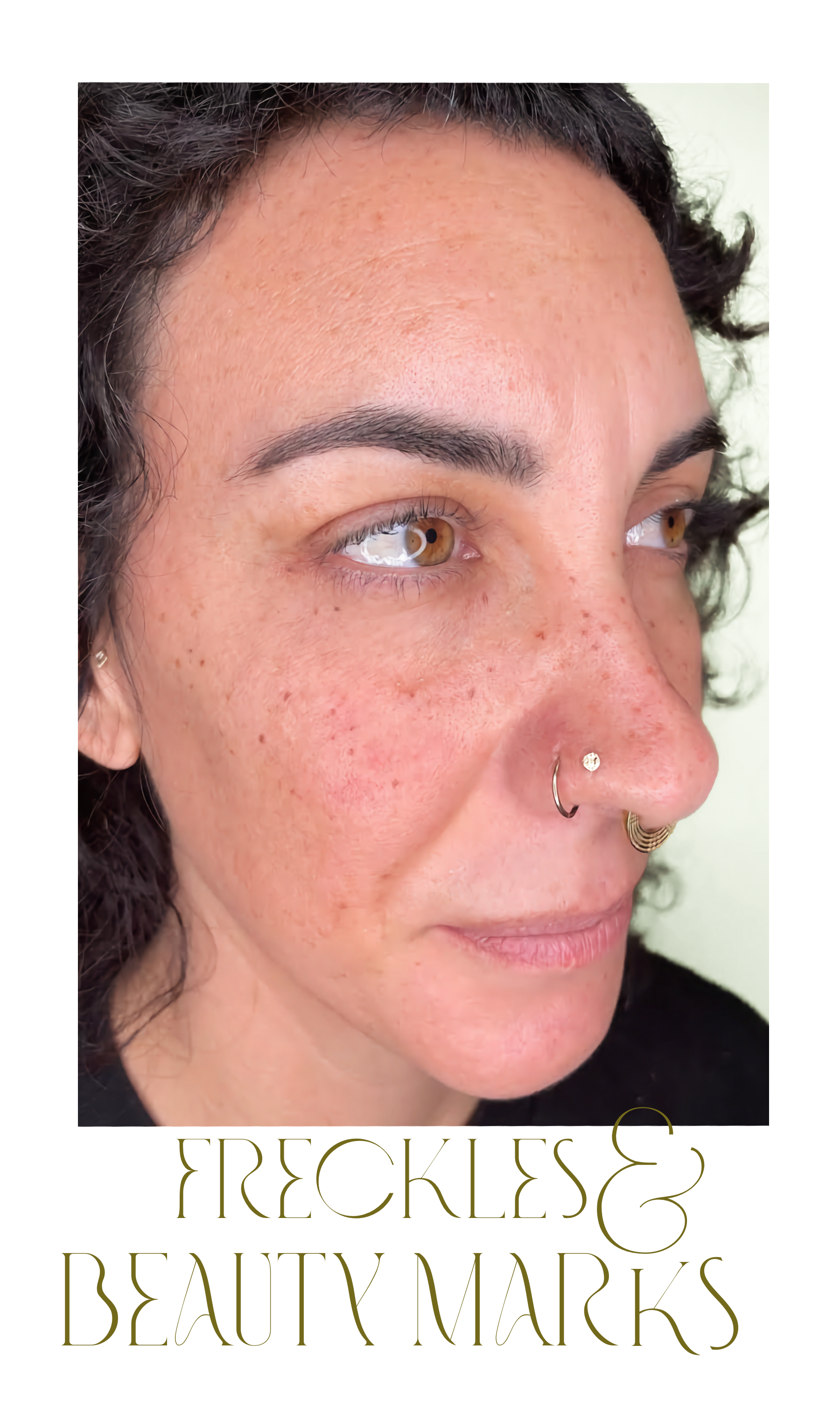 Freckles.png