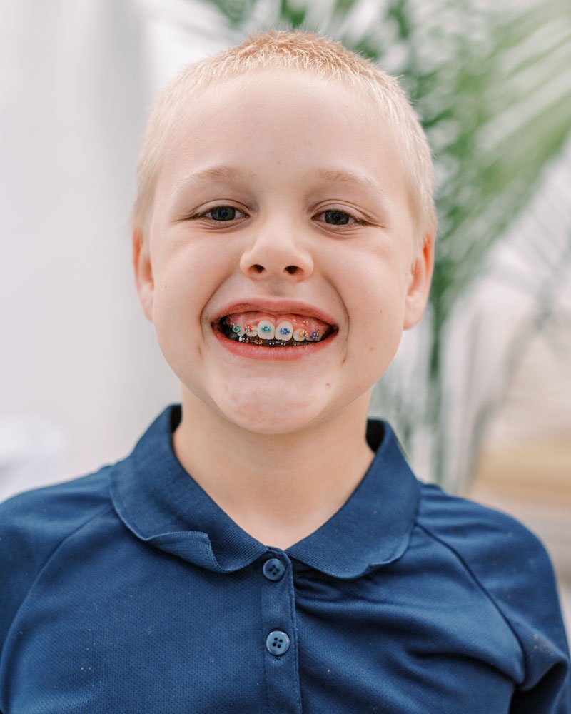 A young boy with braces smiling, wearing a navy blue collared shirt, standing indoors with blurred greenery in the background.