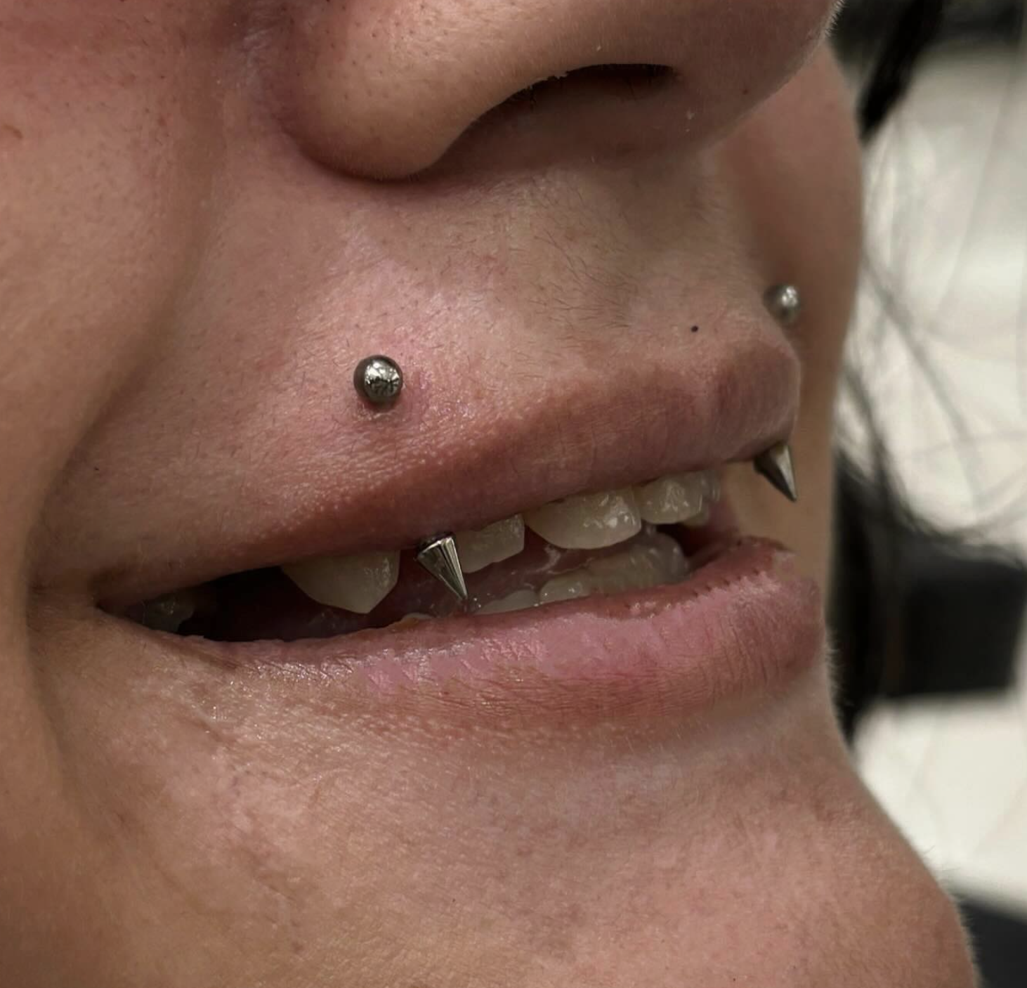 Close-up of a person's mouth and nose, showing facial piercings, including a septum and nostril piercings, and a lip piercing with a spike. The person has braces on their teeth.