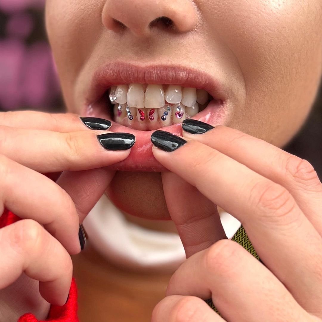 Tooth Gems in NYC — NYC Walk-In Tattoos, Piercings, & Tooth Gems