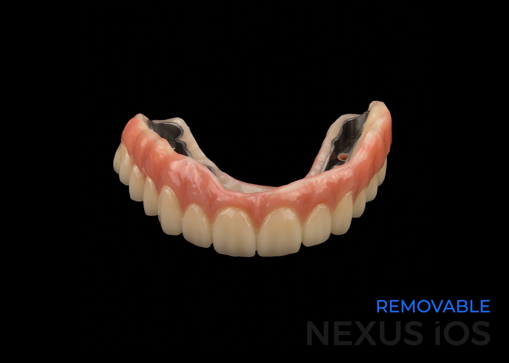 Nexus Removable
