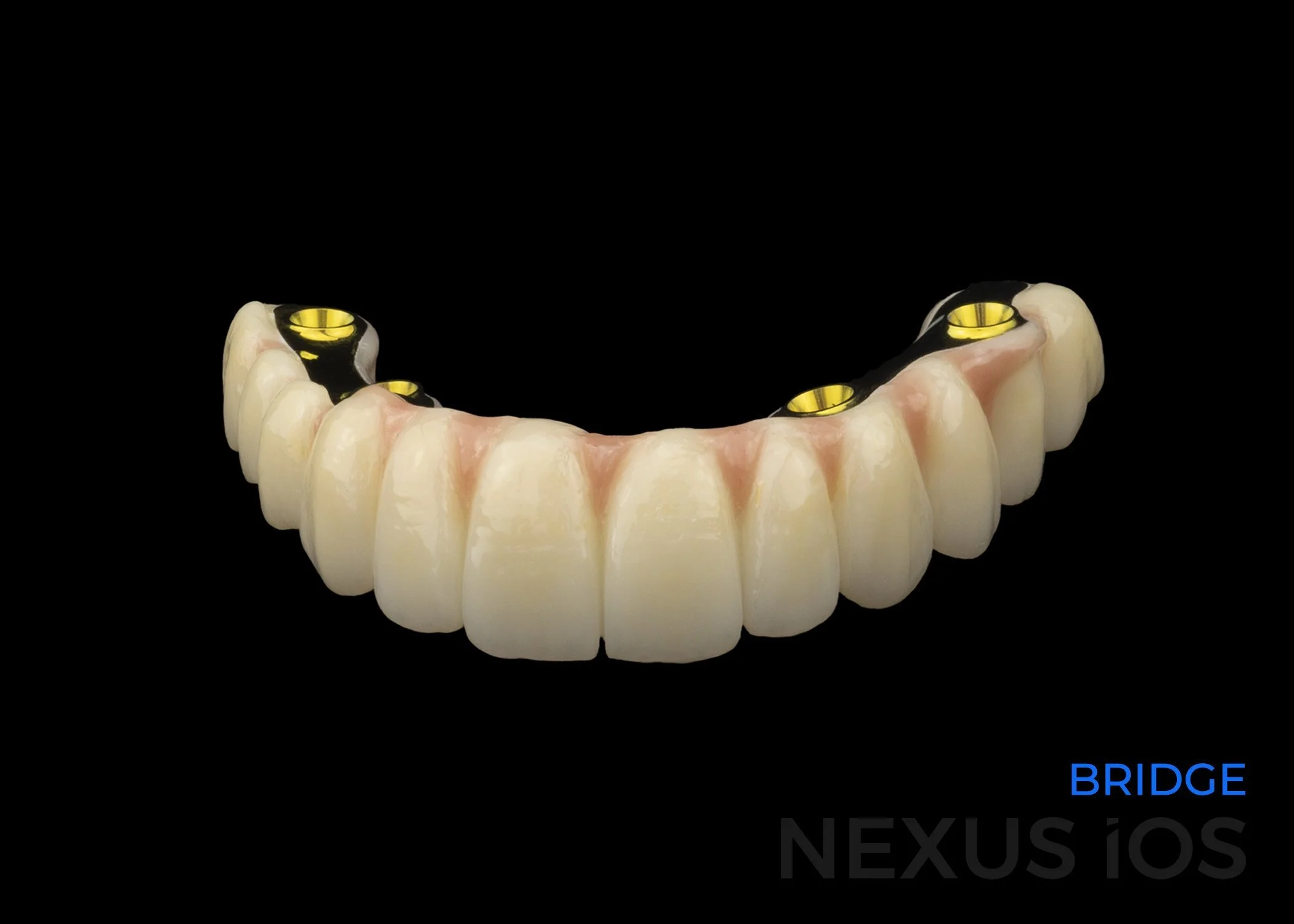 Nexus Bridge