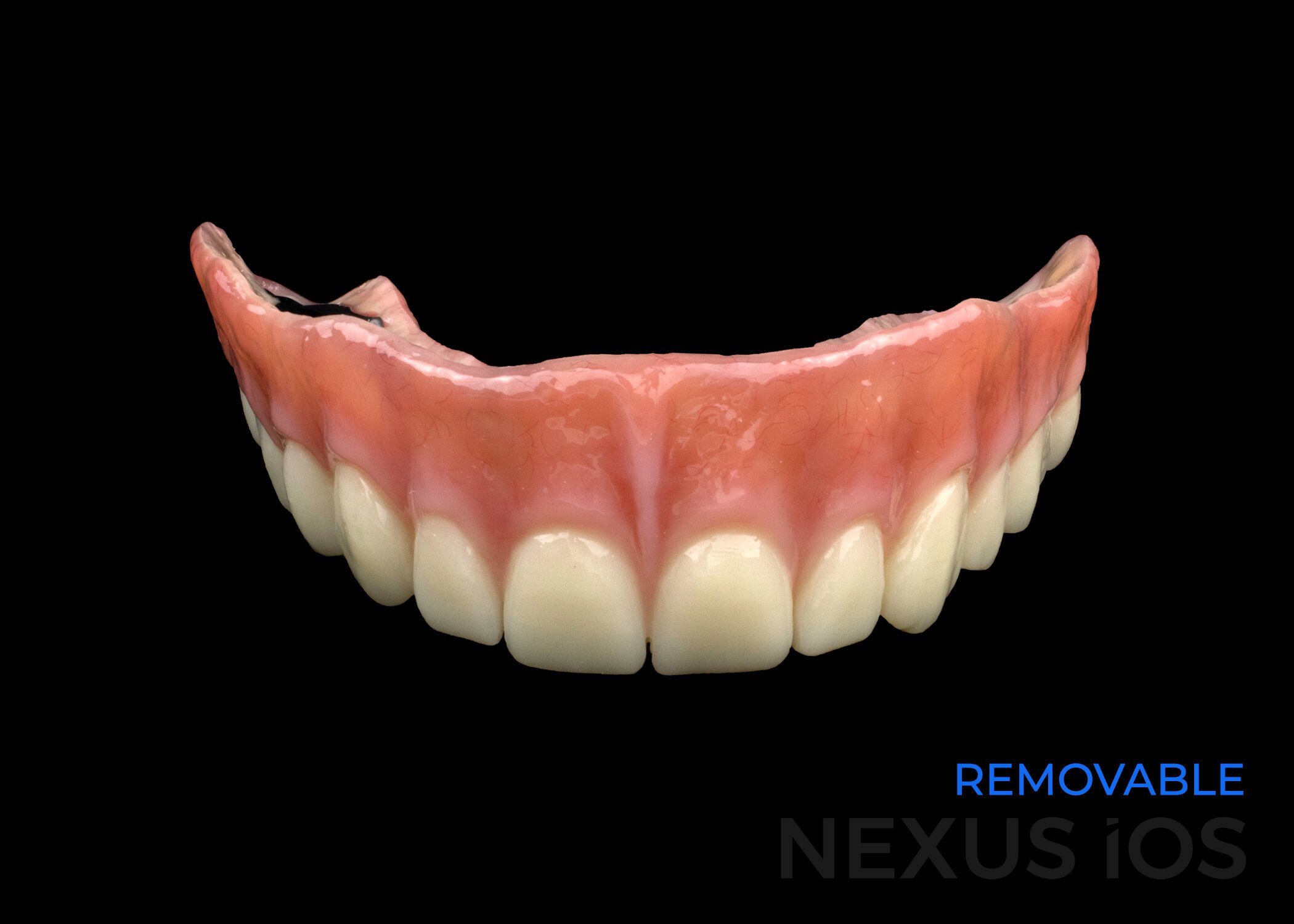 Nexus Removable