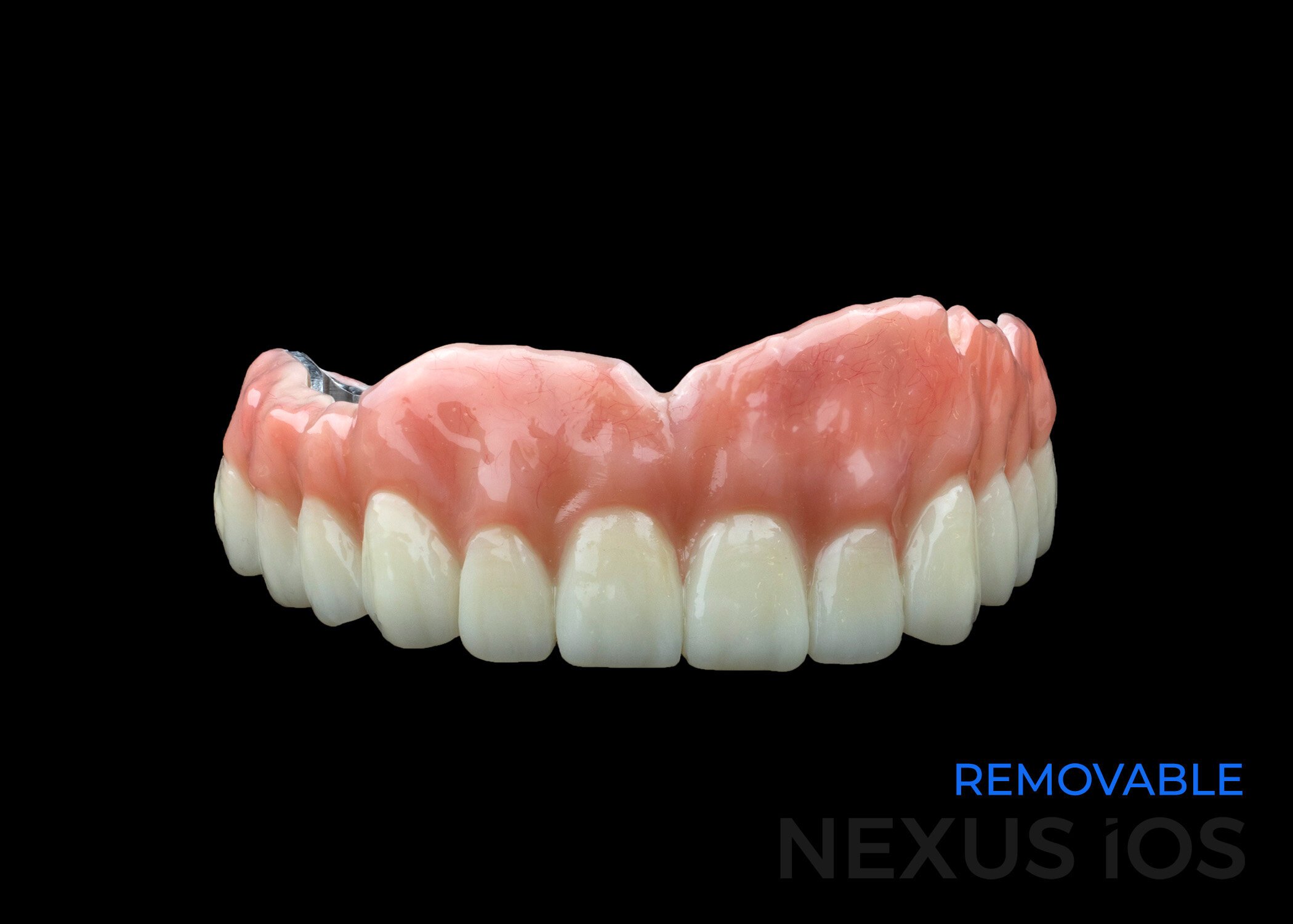 Nexus Removable
