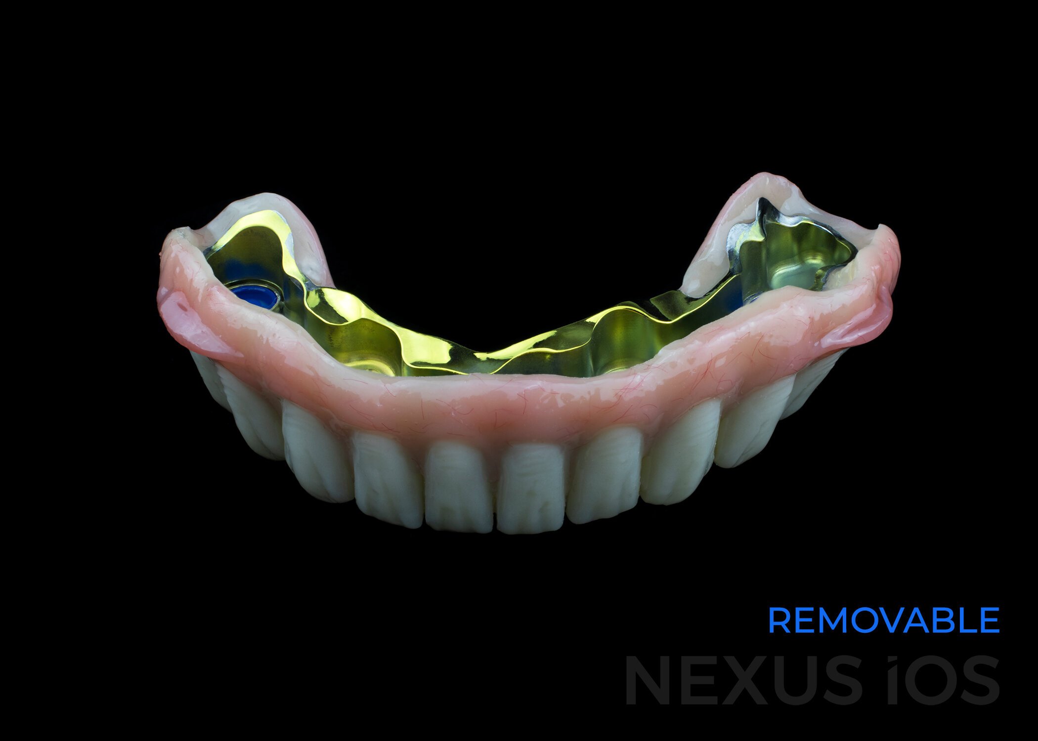Nexus Removable