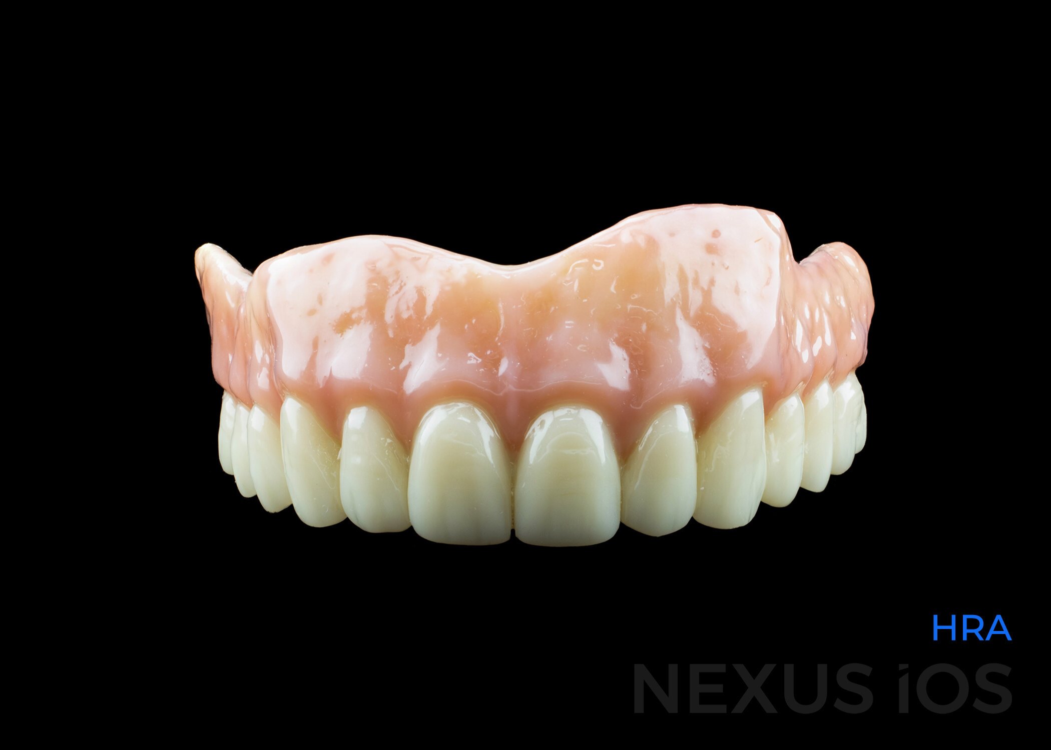 Nexus HRA