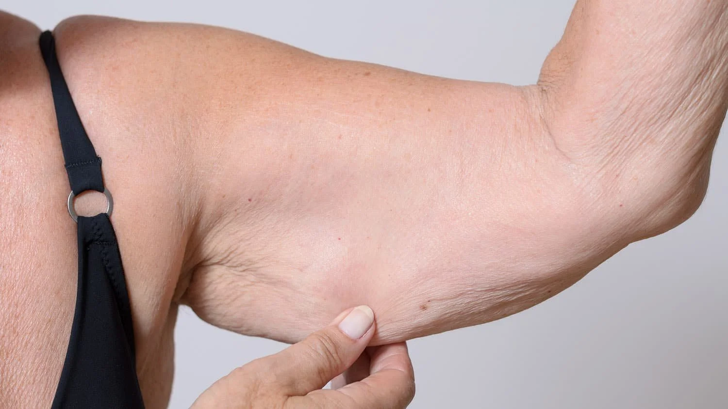 Sarcopenia: The Silent Loss of Strength&nbsp;