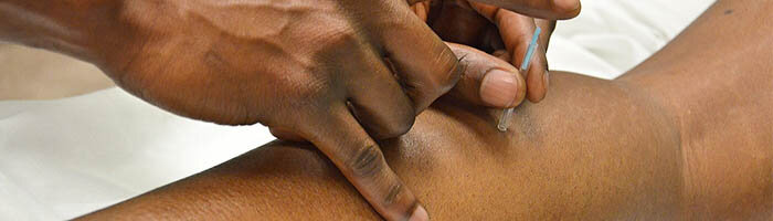 Dry needling
