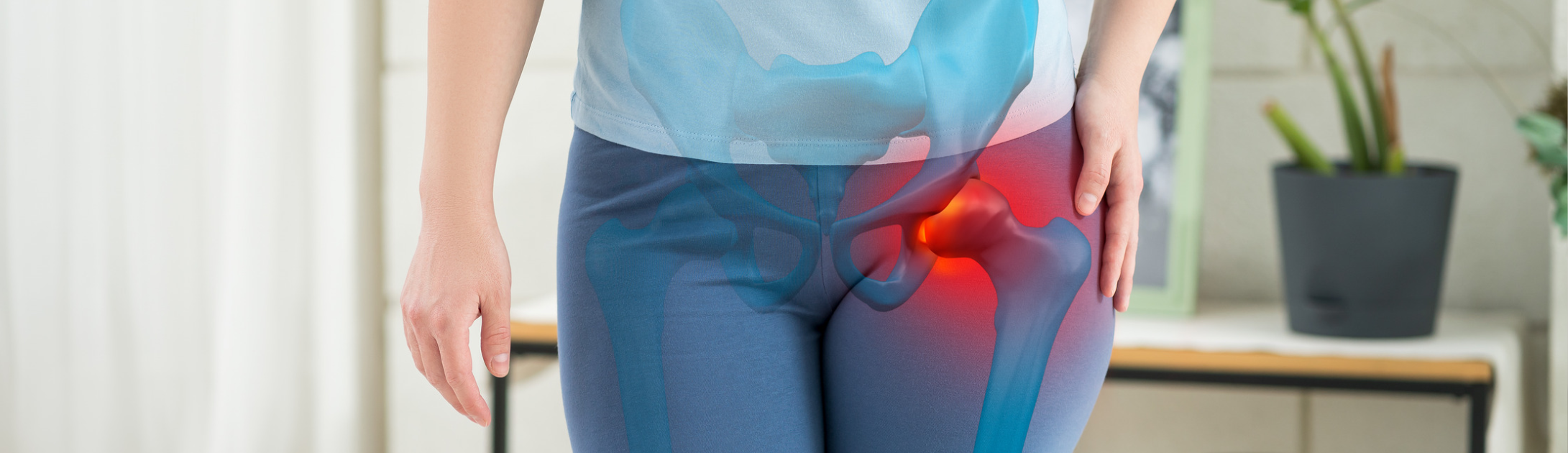 Snapping Hip Syndrome
