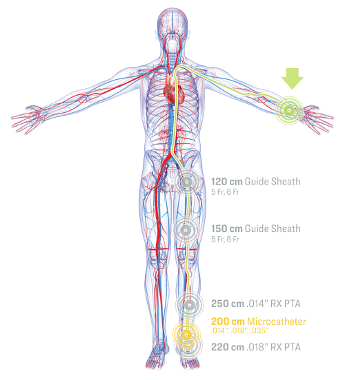 sublime-microcatheter-sublime-radial-access-platform