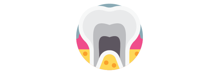 Root Canals