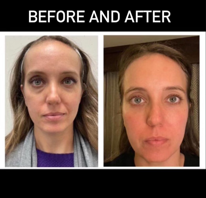 B&A.jpg