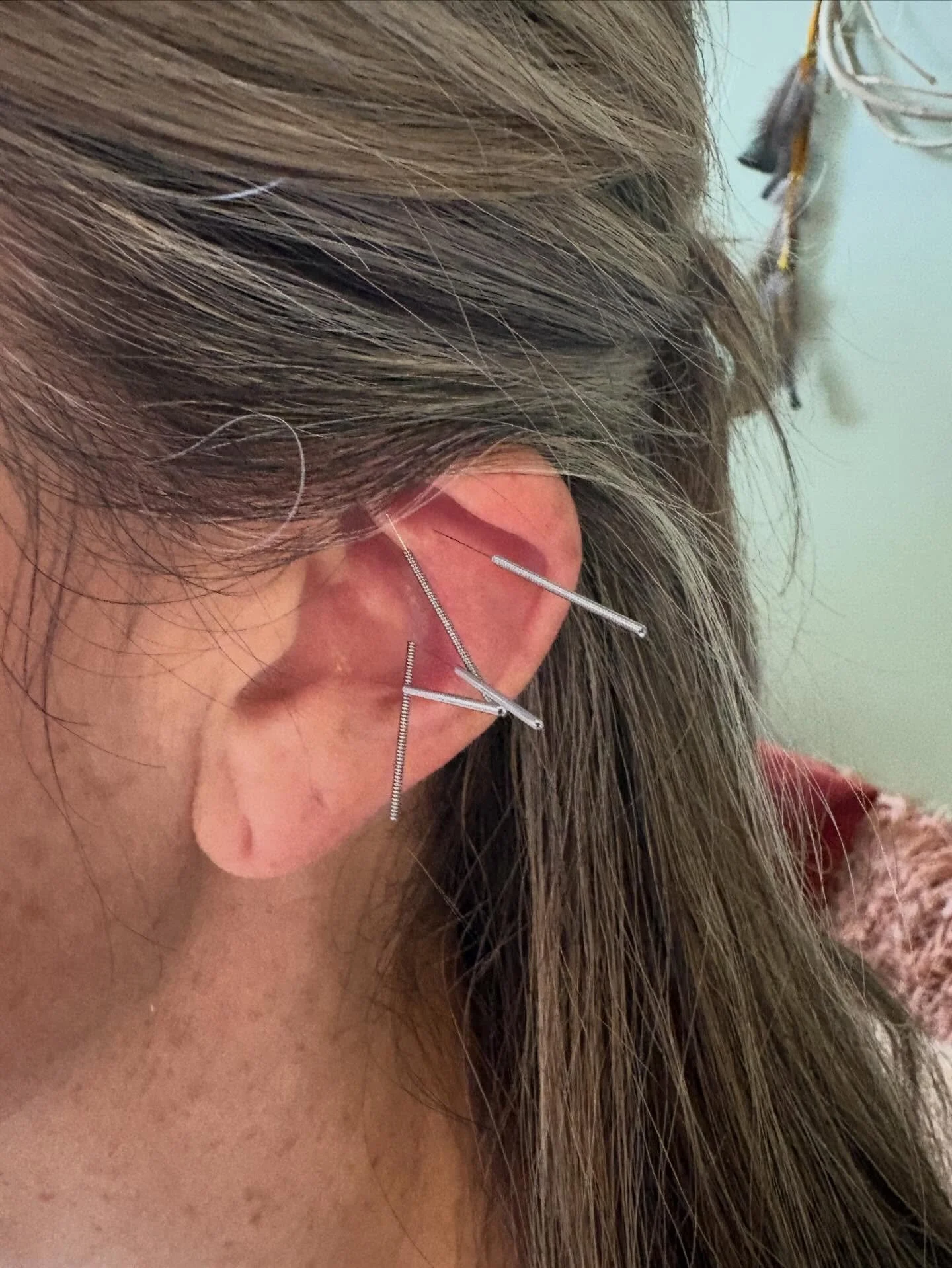 Testing hormones is complex. This is where genetics come into play. 

As a woman, with a slow COMT and MTHFR genetic variant, I metabolize estrogen slower, making me prone to estrogen dominance and at a higher risk for estrogenic cancers. 

For me th