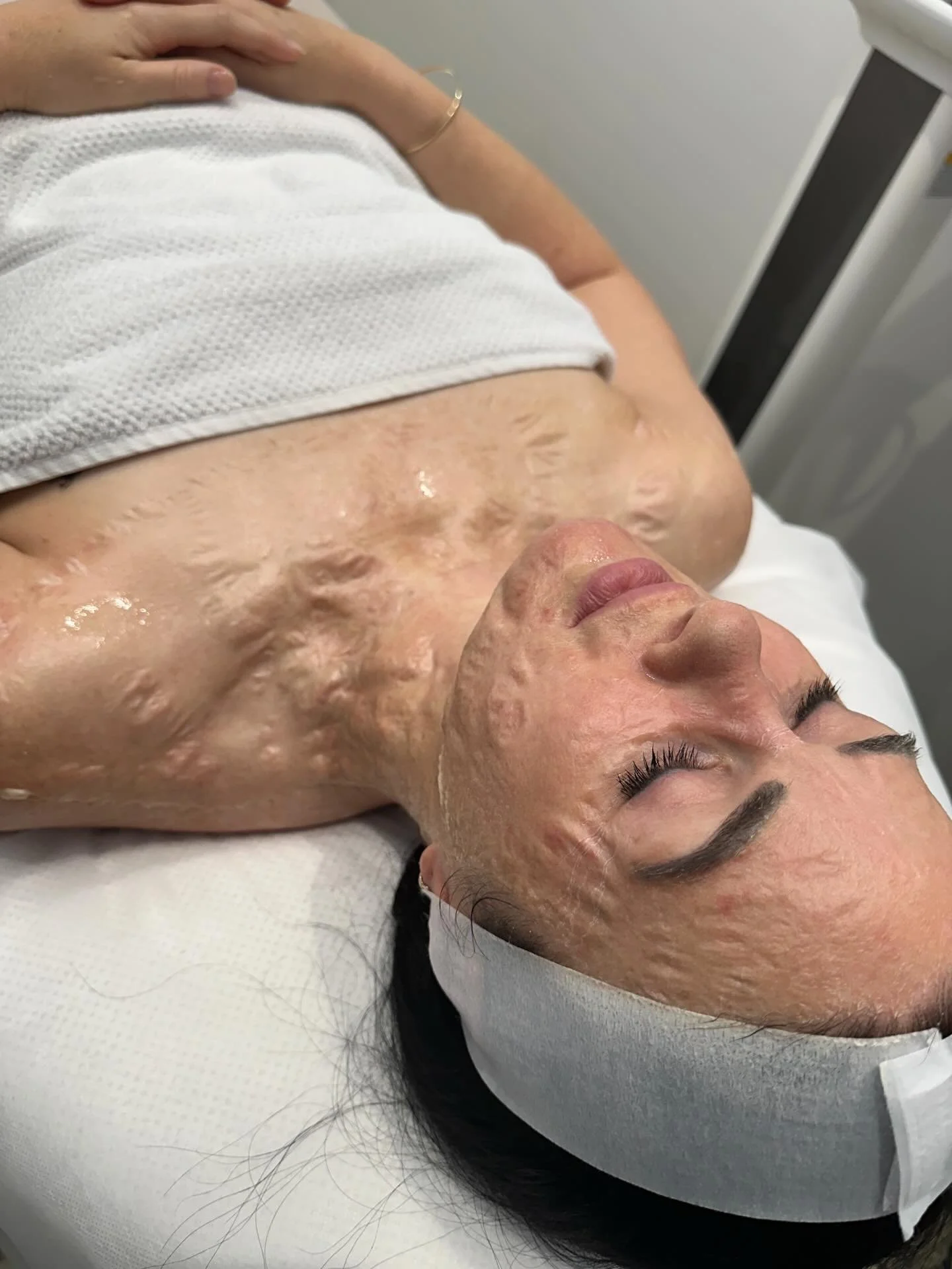Do not be afraid! 

This is what a DMK Enzyme Therapy Treatment Masque looks like. It applies white and as the masque hardens it causes an intense tightening sensation with a pulse/heart beat like effect. 

It also causes a post treatment &ldquo;plas
