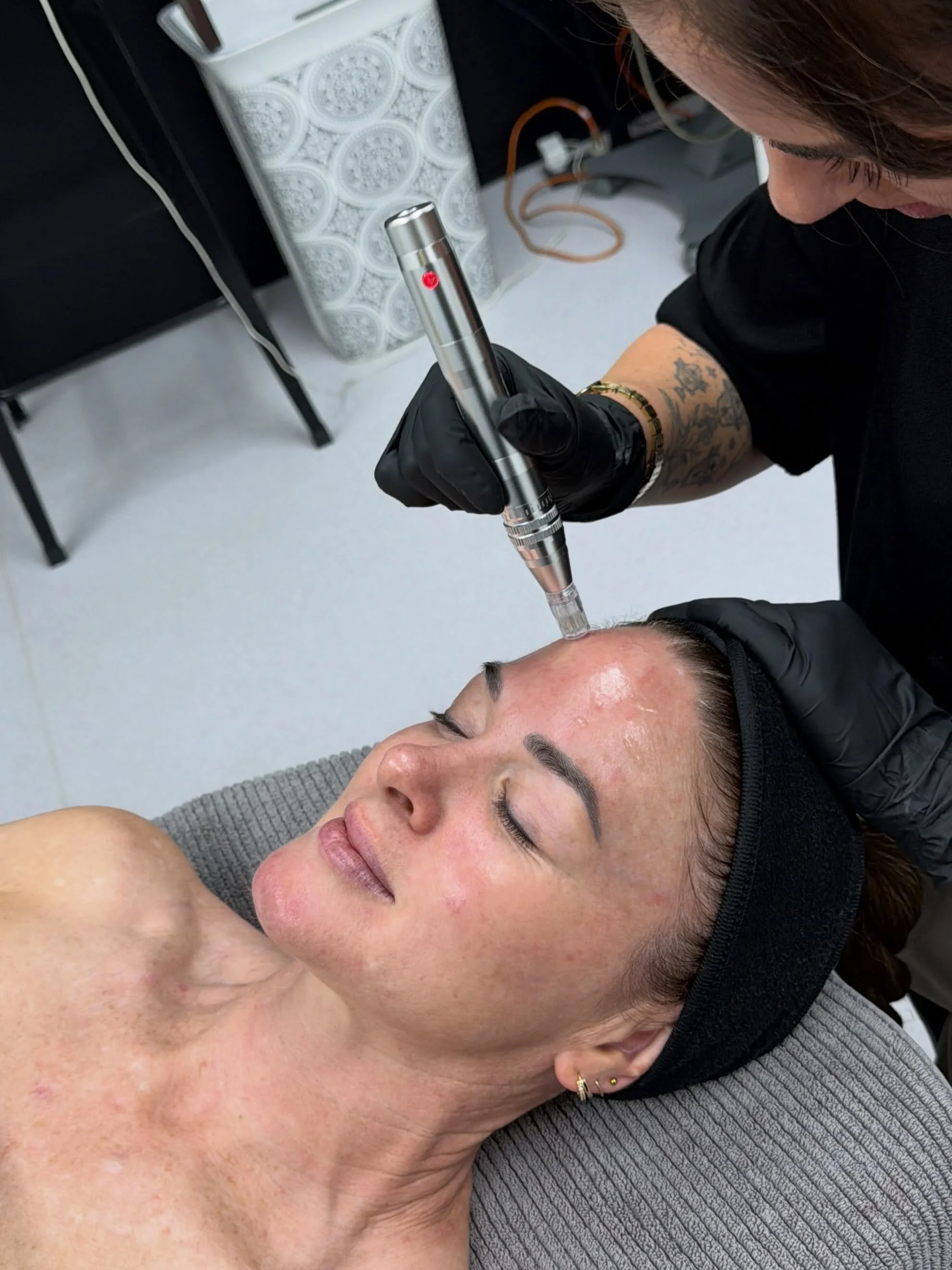 Easily my favourite beauty treatment of the year so far. With 5x MORE POWERFUL RESULTS THAN MICRONEEDLING ALONE. 

I trialled the micro channel infusion (a very fancy new term for microneedling) using Medik8&rsquo;s new PDRN Prismatic+ Pro Concentrat