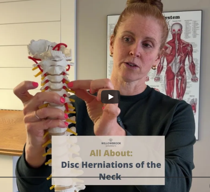 All About: Disc Herniations of the Neck
