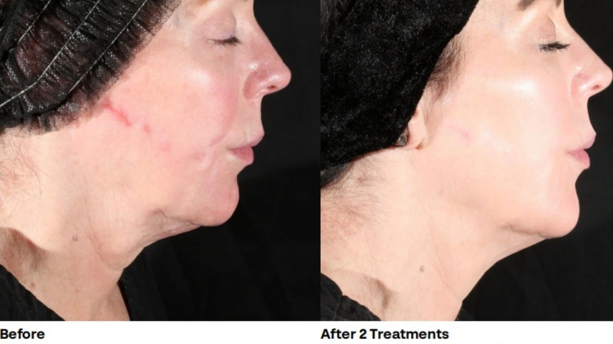 woman before and after