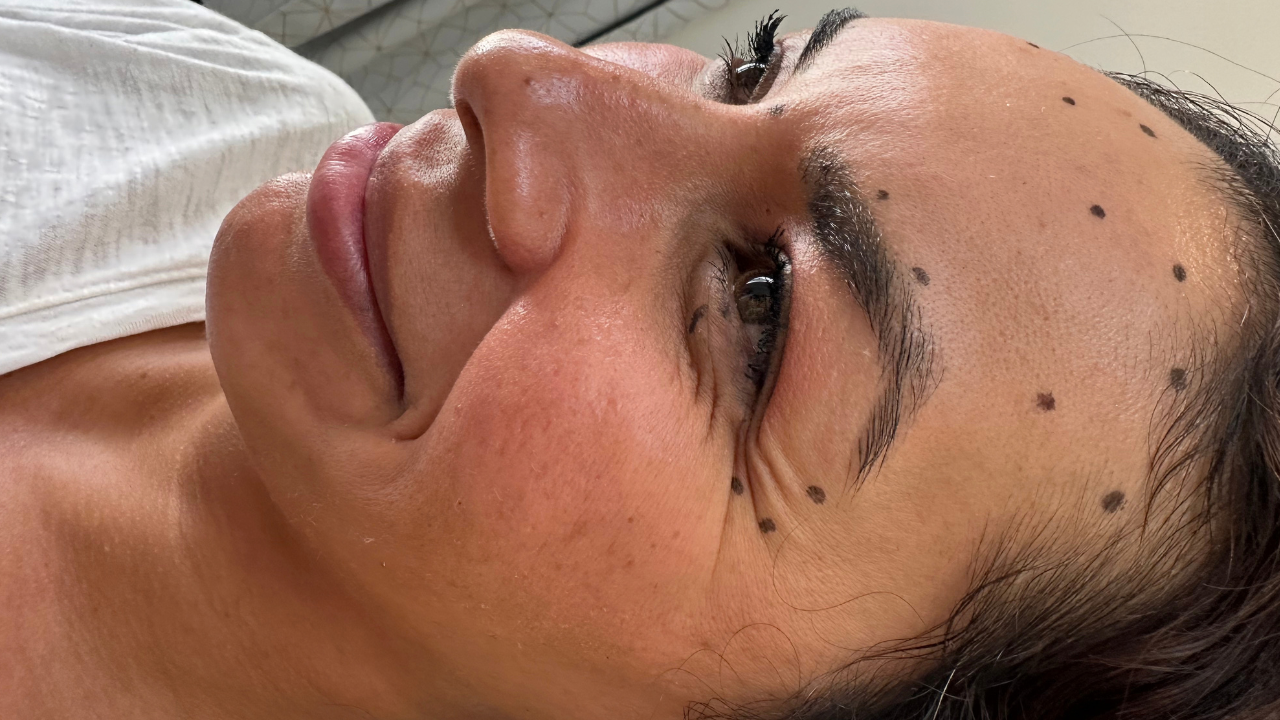girl getting botox